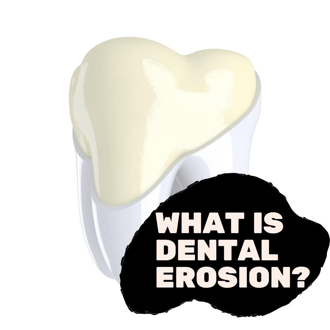 What is Dental Erosion